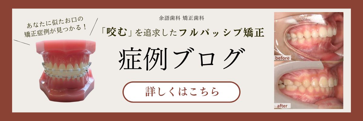 フルパッシブ矯正（成人矯正） | 名古屋市千種区の歯医者｜余語歯科
